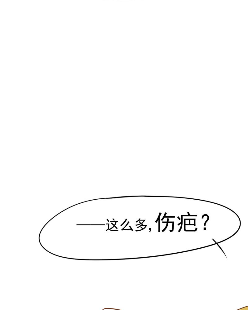 第13章：刮痧25