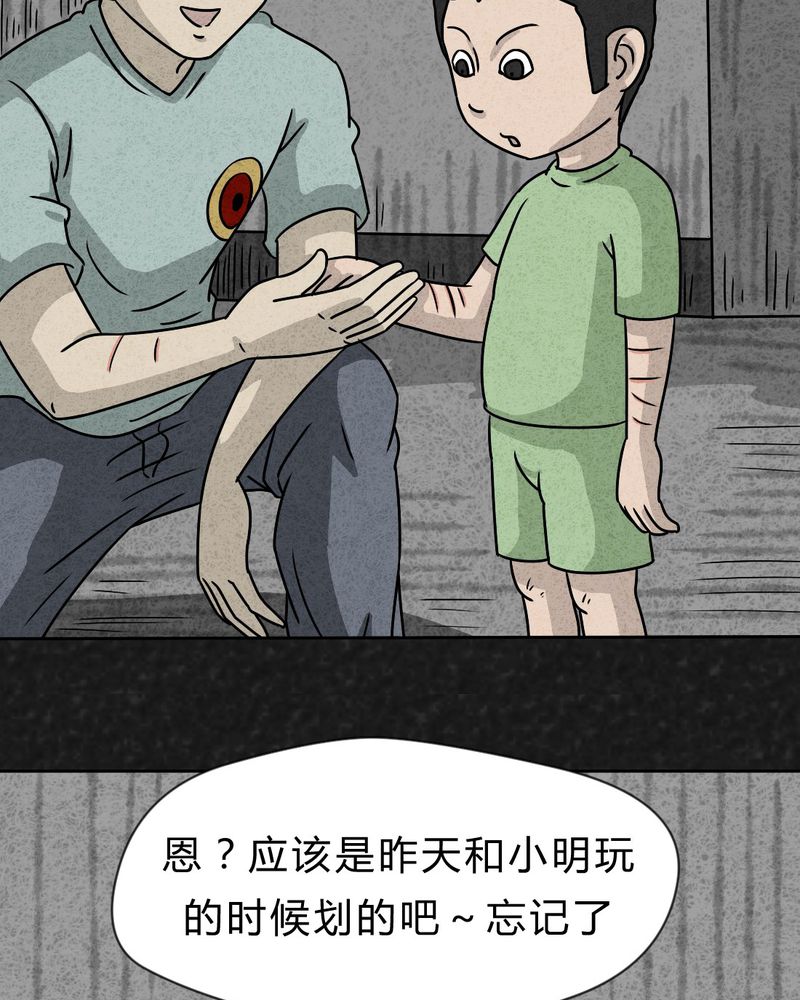 第22章：划痕8