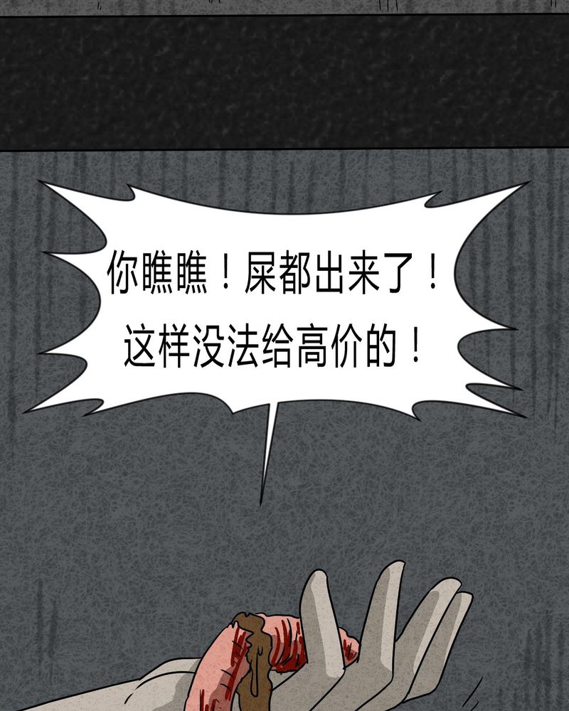 第20章：内脏大盗上45