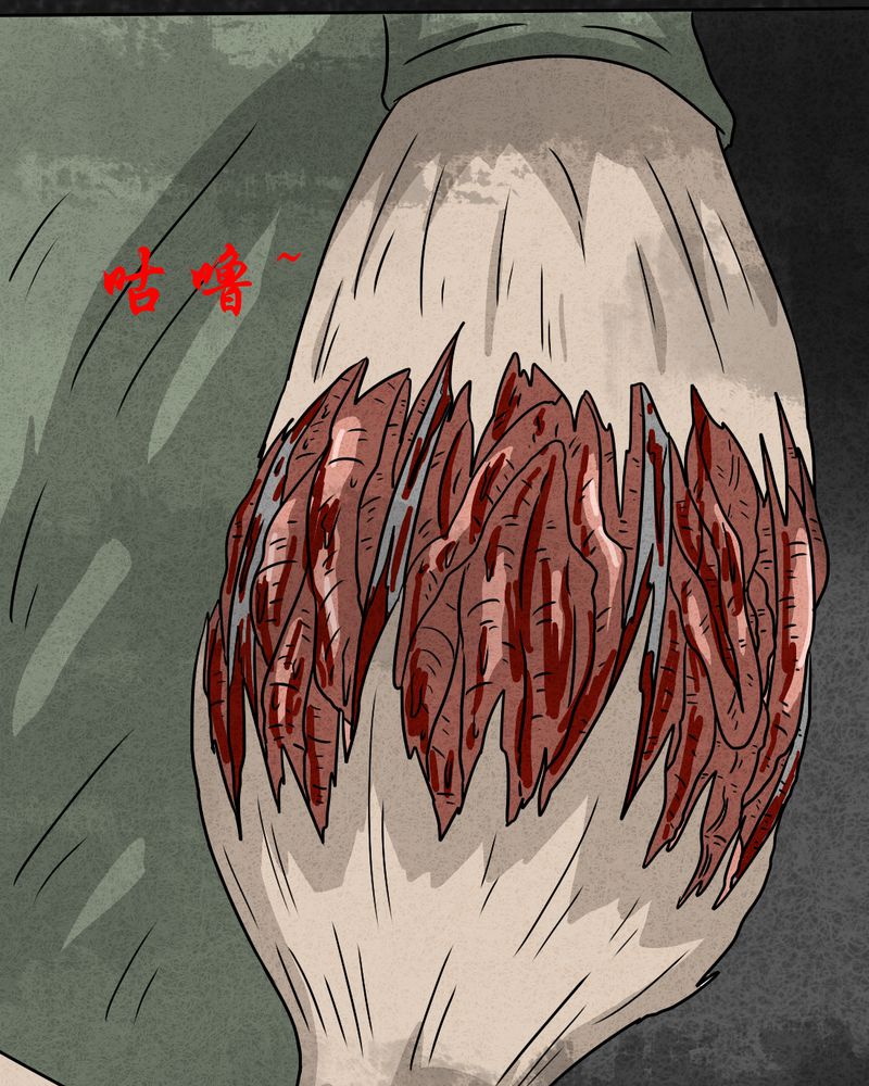 第21章：内脏大盗下29