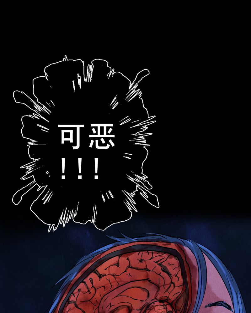第3章：解剖（三）43