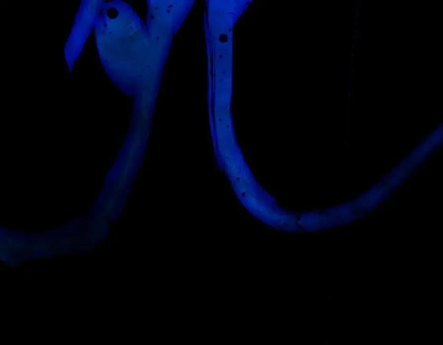 第三十回 将死39